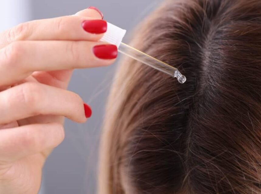 Se ve una area capilar, la mano de una mujer sostiene un gotero, como aplicando algún producto en el cuero cabelludo.