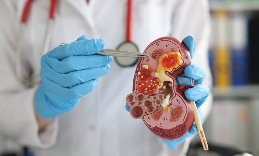 Personal de la salud sostiene un riñón de plástico mientras señala sus componentes con una lapicera.