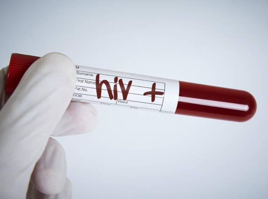 Prueba de sangre en manos de un laboratorista con guantes. Te contamos los síntomas del VIH.