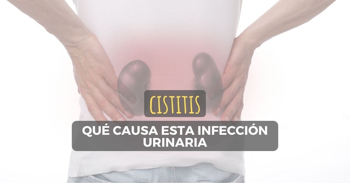 Cistitis: Qué causa esta infección urinaria