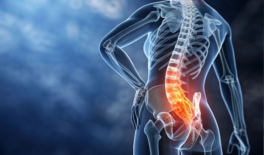 Dolor lumbar que se irradia hacia la pierna causado por la compresión del nervio ciático. Ejercicios y hábitos para prevenir y aliviar la ciática.
