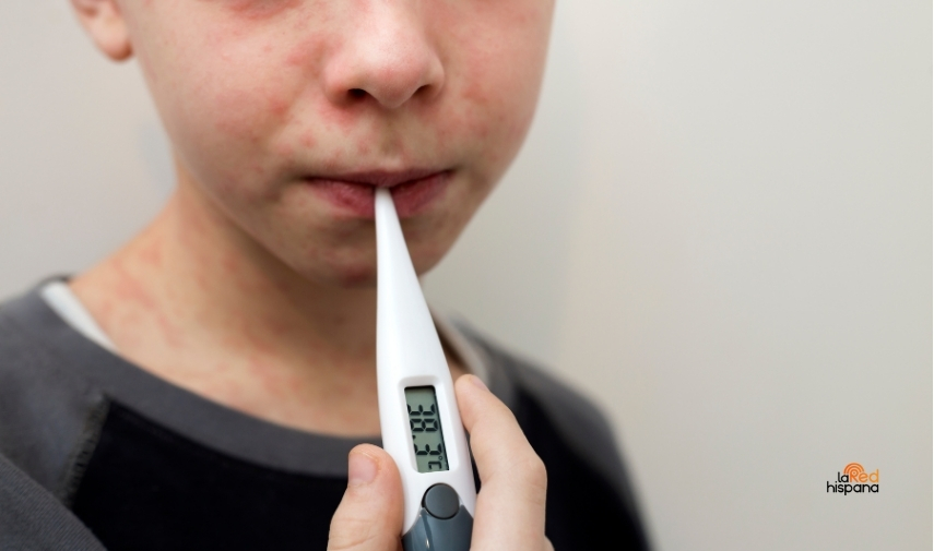 Estados Unidos podría perder su estatus de país libre de sarampión