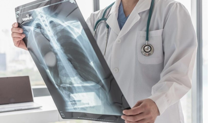 Las pruebas de detección de cáncer de pulmón pueden reducir el riesgo de morir por esta enfermedad, pero muchos adultos que cumplen los requisitos todavía no se realizan las tomografías anuales recomendadas.