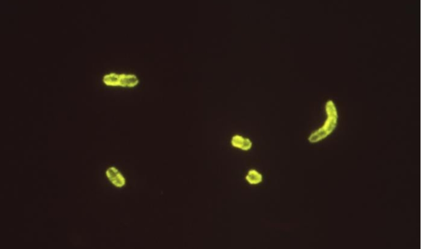 Peste, bacterias, salud, enfermedad